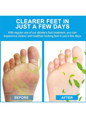 Sumifun - Foot Anti-Bacterial Cream
